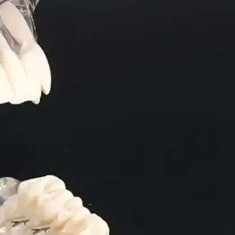 Модель зубного имплантата, модель зуба для стоматологов, учебное пособие для изучения заболеваний зубов
Модель зубного имплантата, модель зуба для стоматологов, учебное пособие для изучения заболеваний зубов