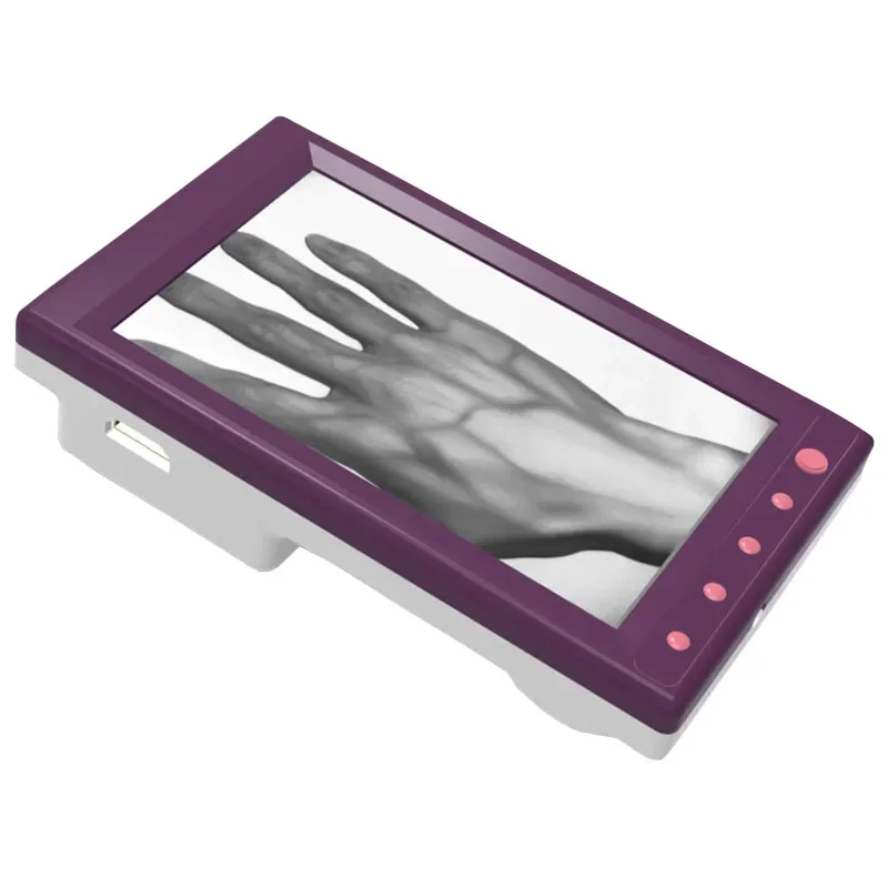 Medical-assisted injection to find veins to help doctors locate venous devices Vein observation system Vein
Medical-assisted injection to find veins to help doctors locate venous devices Vein observation system Vein
