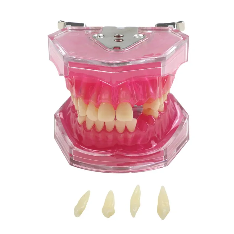 Dental Extraction Model Dental Practice Tooth Extraction All Teeth Detachable Teaching Model Dental Instrument
Dental Extraction Model Dental Practice Tooth Extraction All Teeth Detachable Teaching Model Dental Instrument