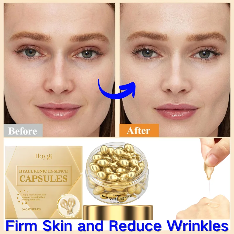 30Pcs Hyaluronic Acid Face Care Capsules Serum Spot Acne Wrinkle Remover Firming Whitening Collagen Essence Skin Care New style
30Pcs Hyaluronic Acid Face Care Capsules Serum Spot Acne Wrinkle Remover Firming Whitening Collagen Essence Skin Care New style
