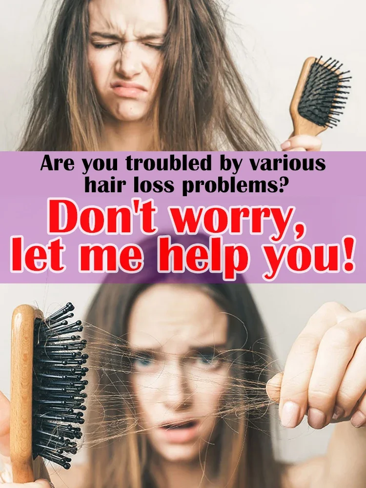 O óleo de crescimento capilar faz o cabelo crescer rapidamente, repara eficazmente a calvície e a queda de cabelo hereditária
O óleo de crescimento capilar faz o cabelo crescer rapidamente, repara eficazmente a calvície e a queda de cabelo hereditária