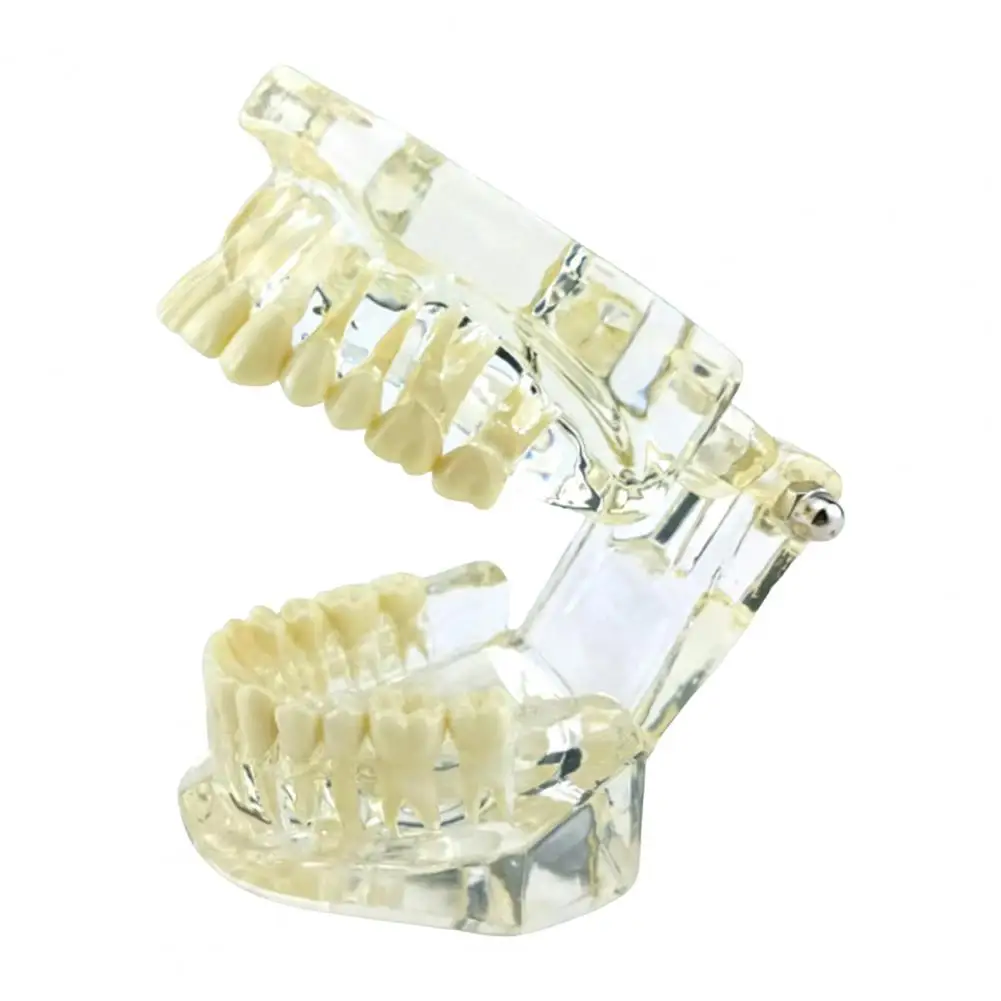 Dental Implant Model Dental Implant Orthodontic Teaching Models for Dentist Students Removable Teeth for Prosthetic
Dental Implant Model Dental Implant Orthodontic Teaching Models for Dentist Students Removable Teeth for Prosthetic