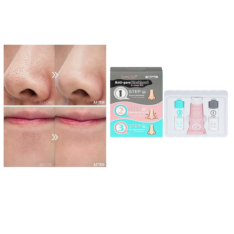 Blackhead Removal Cream Deep Cleansing Pore Mud Cream Pure Natural Oil Control Pore Shrinking Cream Professional Skin Care
Blackhead Removal Cream Deep Cleansing Pore Mud Cream Pure Natural Oil Control Pore Shrinking Cream Professional Skin Care