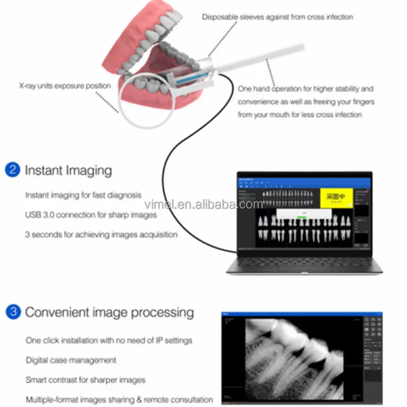 Bigger Size 2 Dental oral cavity treatment portable x ray sensor price RVG radiography intraoral xray sensor
Bigger Size 2 Dental oral cavity treatment portable x ray sensor price RVG radiography intraoral xray sensor