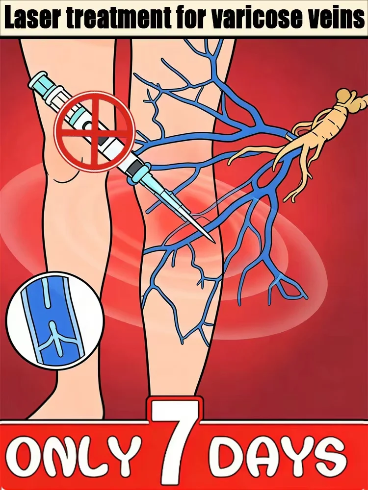 ᴸᵉᵍ ᶜᵃʳᵉ ᵗᵒᵒˡˢ ᶜᵃⁿ ⁱᵐᵖʳᵒᵛᵉ the function of venous valves, sᴛʀᴇɴɢᴛʜᴇɴ ᴛʜᴇ ᴠᴇɪɴ walls, and m
ᴸᵉᵍ ᶜᵃʳᵉ ᵗᵒᵒˡˢ ᶜᵃⁿ ⁱᵐᵖʳᵒᵛᵉ the function of venous valves, sᴛʀᴇɴɢᴛʜᴇɴ ᴛʜᴇ ᴠᴇɪɴ walls, and m
