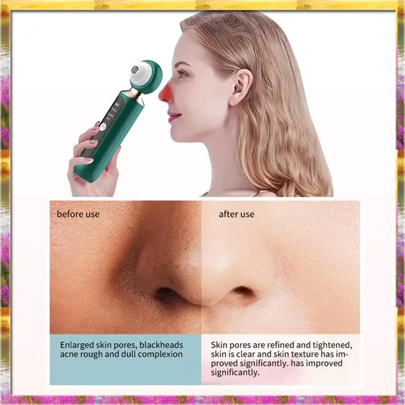 Y26A New Facial Pore Cleaning Device Adjustable With LED Light Visualization For Personal Health Care White
Y26A New Facial Pore Cleaning Device Adjustable With LED Light Visualization For Personal Health Care White
