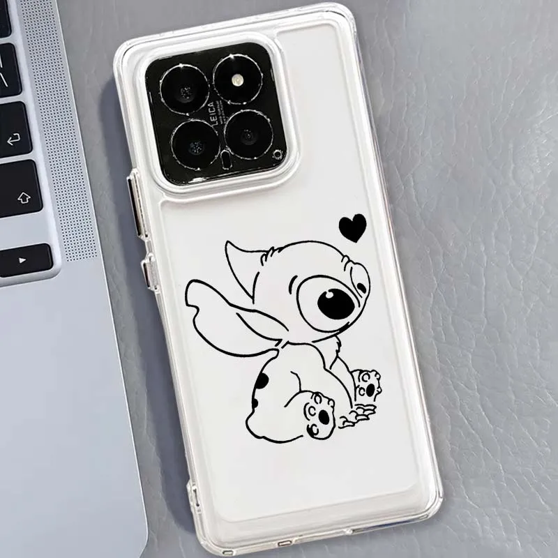 Line Stitch Angel Phone Case For Xiaomi 17 15 14 13 12 12S 12X 12T 11 11T Pro max Lite ultra TPU Transparent
Line Stitch Angel Phone Case For Xiaomi 17 15 14 13 12 12S 12X 12T 11 11T Pro max Lite ultra TPU Transparent