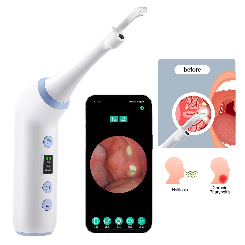 Visual Tonsil Stone Removal Camera with LED Light Electric Stone Tonsil Remover Kit Oral Endoscope Mouth Cleaning Care Tools
Visual Tonsil Stone Removal Camera with LED Light Electric Stone Tonsil Remover Kit Oral Endoscope Mouth Cleaning Care Tools