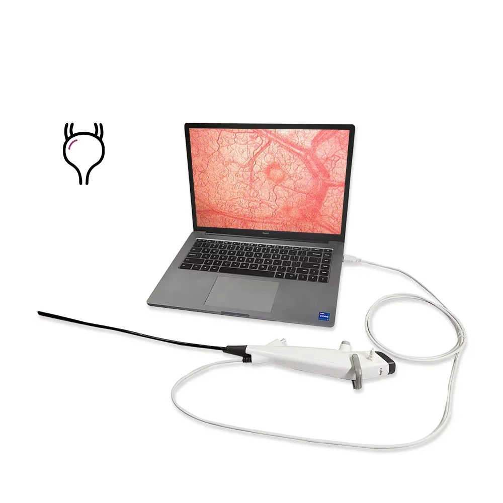 Endoso USB Port Portable Disposable Flexible Cystoscope with 2.4mm Operating Channel for Medical Supplies Urological E
Endoso USB Port Portable Disposable Flexible Cystoscope with 2.4mm Operating Channel for Medical Supplies Urological E
