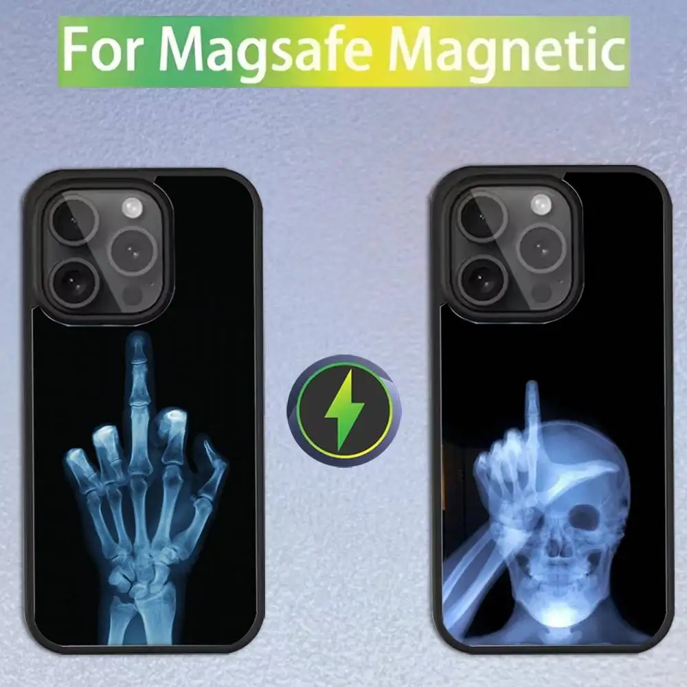 Radiological Human Skeleton Phone Case For iPhone 16,15,14,13,12,11,Pro,Max,Plus,Mini,SE Magsafe Magnetic Wireless Charging
Radiological Human Skeleton Phone Case For iPhone 16,15,14,13,12,11,Pro,Max,Plus,Mini,SE Magsafe Magnetic Wireless Charging