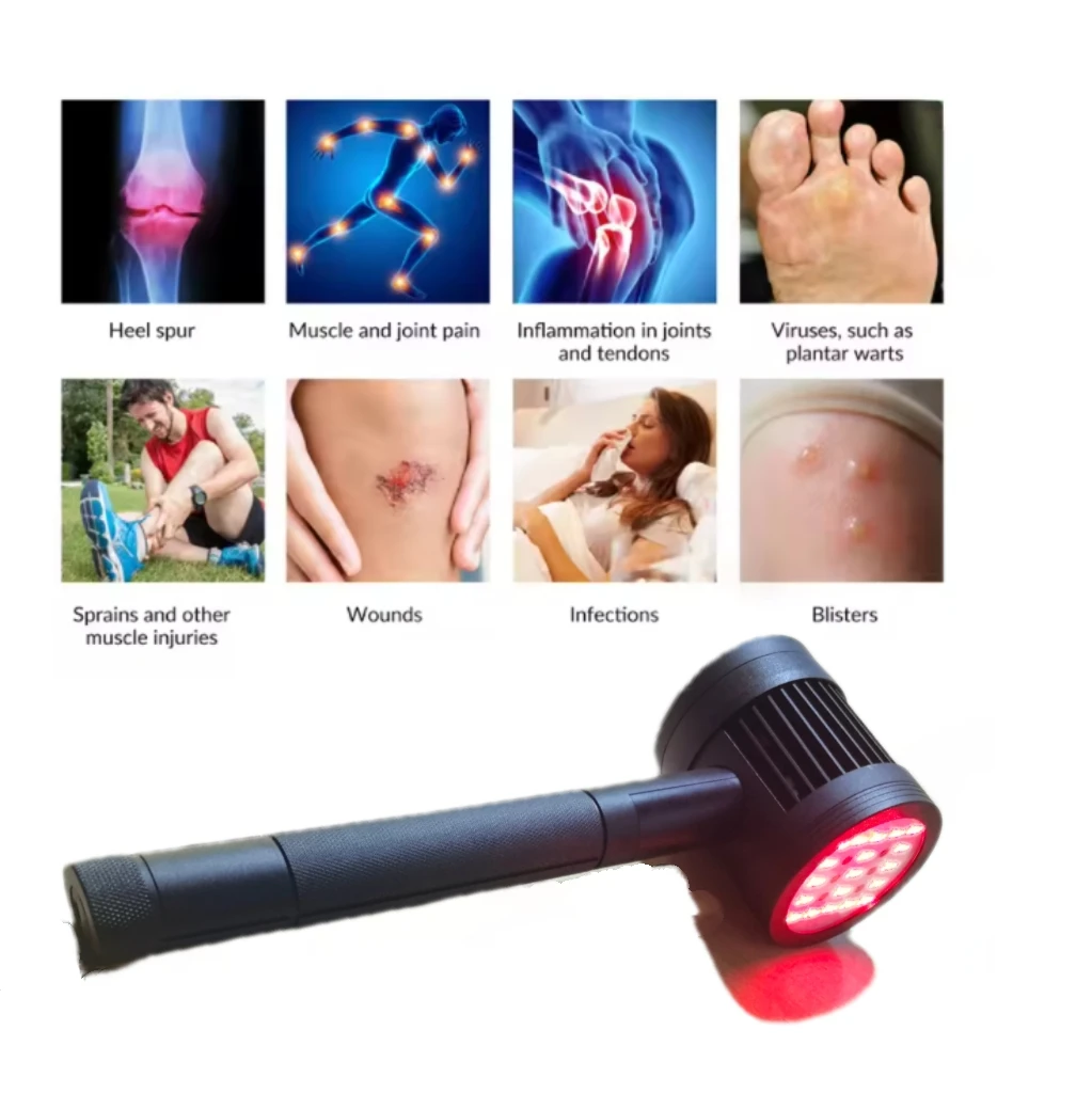 Высокомощный лазерный терапевтический аппарат T05 (1295 мВт) с двойным излучением 650 нм/808 нм для облегчения и заживления боли в коленях и плечах
Высокомощный лазерный терапевтический аппарат T05 (1295 мВт) с двойным излучением 650 нм/808 нм для облегчения и заживления боли в коленях и плечах