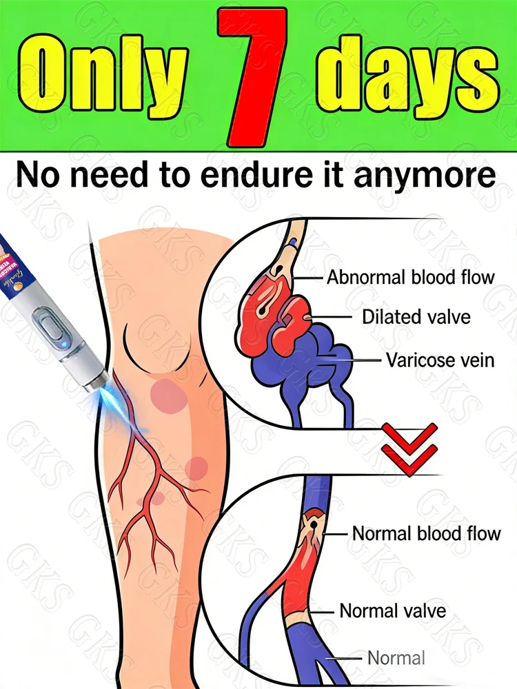 Eliminate leg problems with our second-generation product; technology changes lives.
Eliminate leg problems with our second-generation product; technology changes lives.