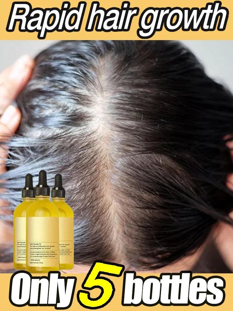 Natural Hair Growth Oil Efficient Anti Hair Loss Nourishing Essential Oil For Dense Repair Damaged Hair Moisturizing Smooth Oil 
Natural Hair Growth Oil Efficient Anti Hair Loss Nourishing Essential Oil For Dense Repair Damaged Hair Moisturizing Smooth Oil