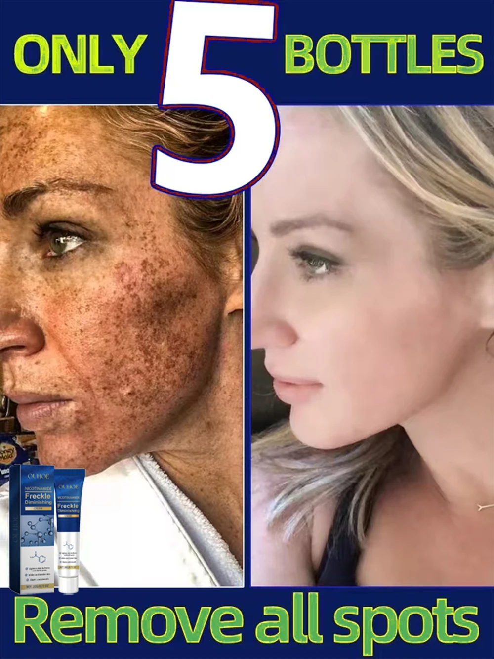 OUHOE Facial Dark Spot Cream Brighten Skin Tone Moisturizing Nourishing Skin Care Hydrating Rejuvenating Face Cream 2025
OUHOE Facial Dark Spot Cream Brighten Skin Tone Moisturizing Nourishing Skin Care Hydrating Rejuvenating Face Cream 2025