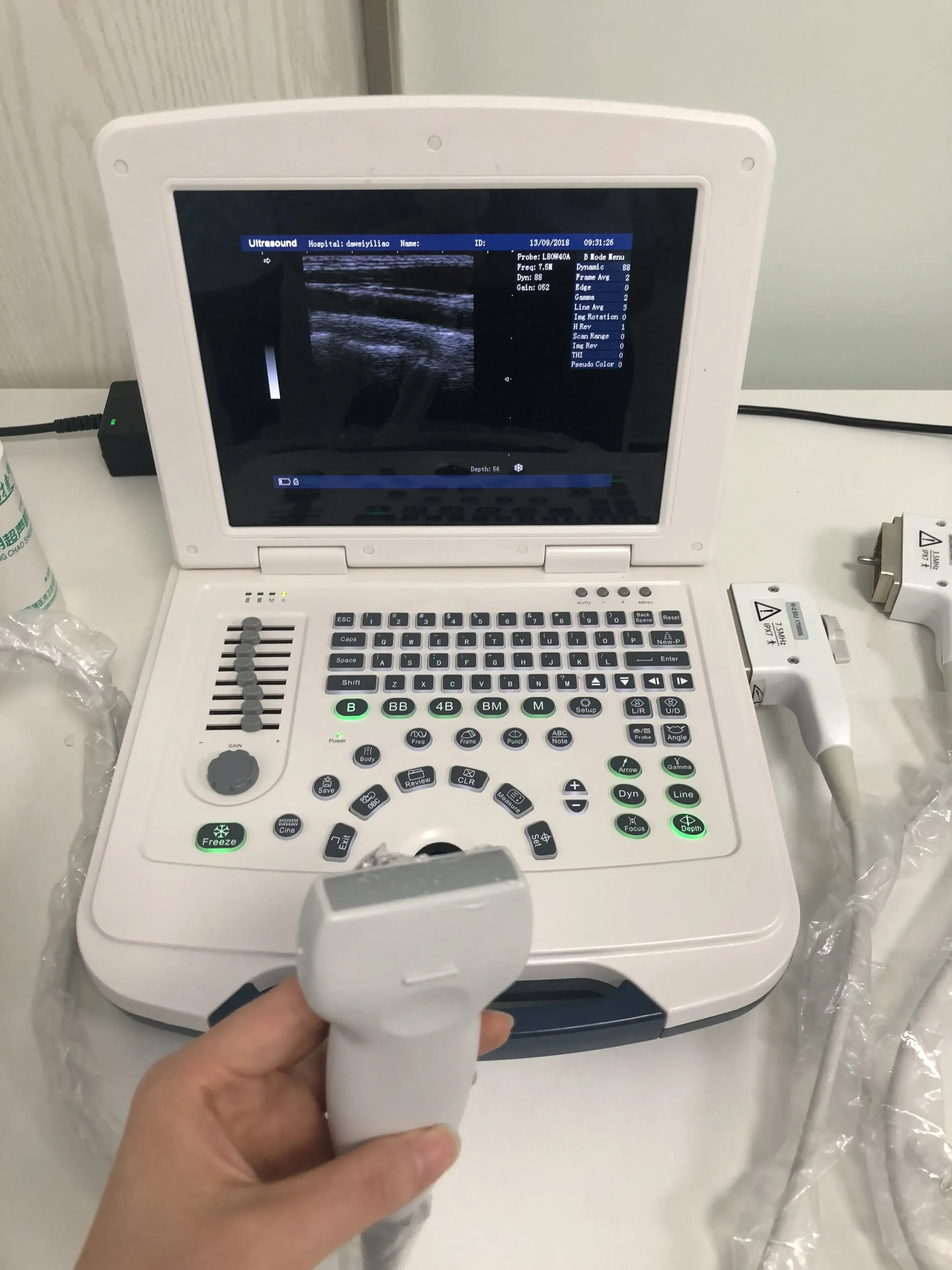 2025EURPET VET Touch Screen ultrasound portable for clinic pet ultrasound machine large LCD display 3D ultrasound
2025EURPET VET Touch Screen ultrasound portable for clinic pet ultrasound machine large LCD display 3D ultrasound