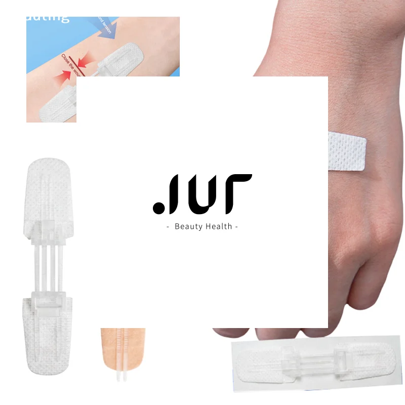 Suture Kit Zipper Band-aid Painless Wound Closure Patch Suture-free Dressing Patches Zip Suture
Suture Kit Zipper Band-aid Painless Wound Closure Patch Suture-free Dressing Patches Zip Suture