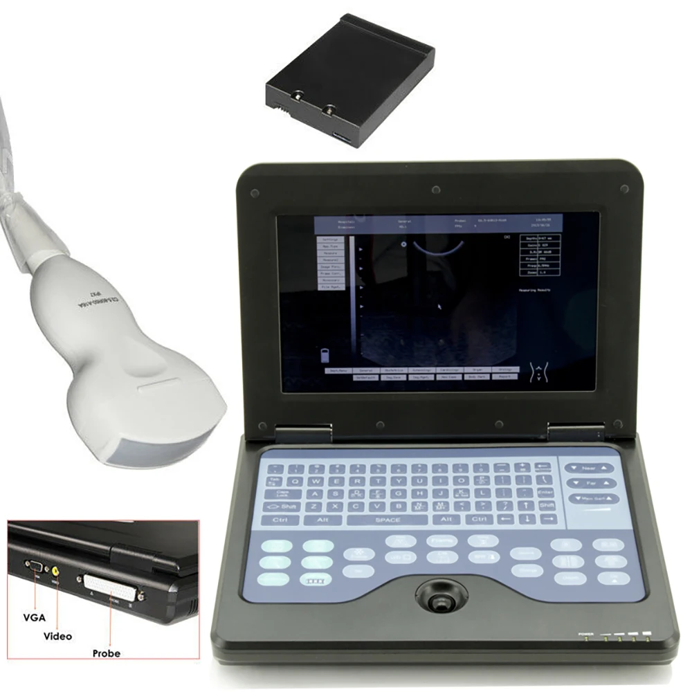 CMS600P2 Portable B Ultrasound Scanner Laptop Abdomen Diagnostic Machine With Probe High Effective Data Processing Ability
CMS600P2 Portable B Ultrasound Scanner Laptop Abdomen Diagnostic Machine With Probe High Effective Data Processing Ability