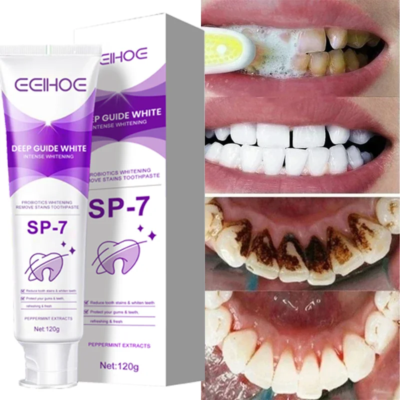 120g SP4 Whitening Probiotic Toothpaste Prevent Dental Caries Repair Paste Teeth Cleaner Plaque Stain Remover Fresh Breath Care 
120g SP4 Whitening Probiotic Toothpaste Prevent Dental Caries Repair Paste Teeth Cleaner Plaque Stain Remover Fresh Breath Care