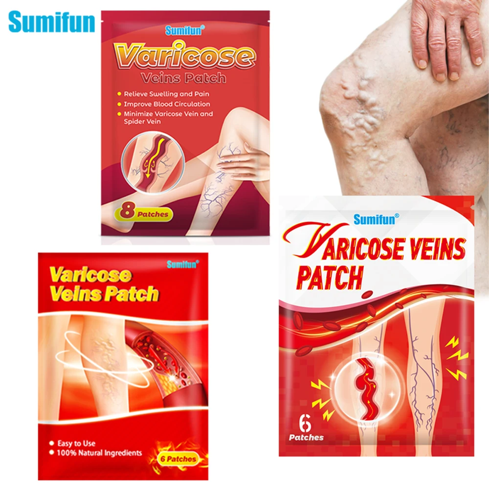 3Types Varicose Veins Patch Varicosity Angiitis Leg Spider Removal Sticker Vasculitis Phlebitis Pain Relif Medical HealthPlaster
3Types Varicose Veins Patch Varicosity Angiitis Leg Spider Removal Sticker Vasculitis Phlebitis Pain Relif Medical HealthPlaster