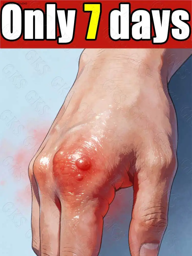 Sᵖʳᵃʸ Cᵃʳᵉ Tᵒᵒˡˢ Fᵒʳ Tʰᵉ Bᵃᶜᵏ⸴ Nᵉᶜᵏ⸴ ʷᵃⁱˢᵗ⸴ ˡᵉᵍˢ⸴ ᵃⁿᵈ ᵏⁿᵉᵉˢ‧
Sᵖʳᵃʸ Cᵃʳᵉ Tᵒᵒˡˢ Fᵒʳ Tʰᵉ Bᵃᶜᵏ⸴ Nᵉᶜᵏ⸴ ʷᵃⁱˢᵗ⸴ ˡᵉᵍˢ⸴ ᵃⁿᵈ ᵏⁿᵉᵉˢ‧