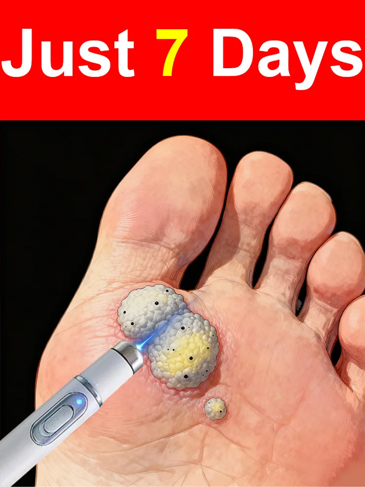 2026 Новое обновление синего лазера для решения бородавок для мужчин и женщин
2026 Новое обновление синего лазера для решения бородавок для мужчин и женщин