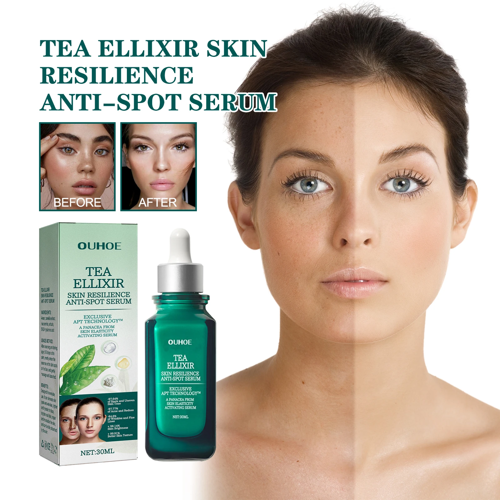 OUHOE Fade Spot Essence осветляет тусклую кожу, восстанавливает, увлажняет, осветляет хлоазму, осветляет кожу и нежная эссенция.
OUHOE Fade Spot Essence осветляет тусклую кожу, восстанавливает, увлажняет, осветляет хлоазму, осветляет кожу и нежная эссенция.