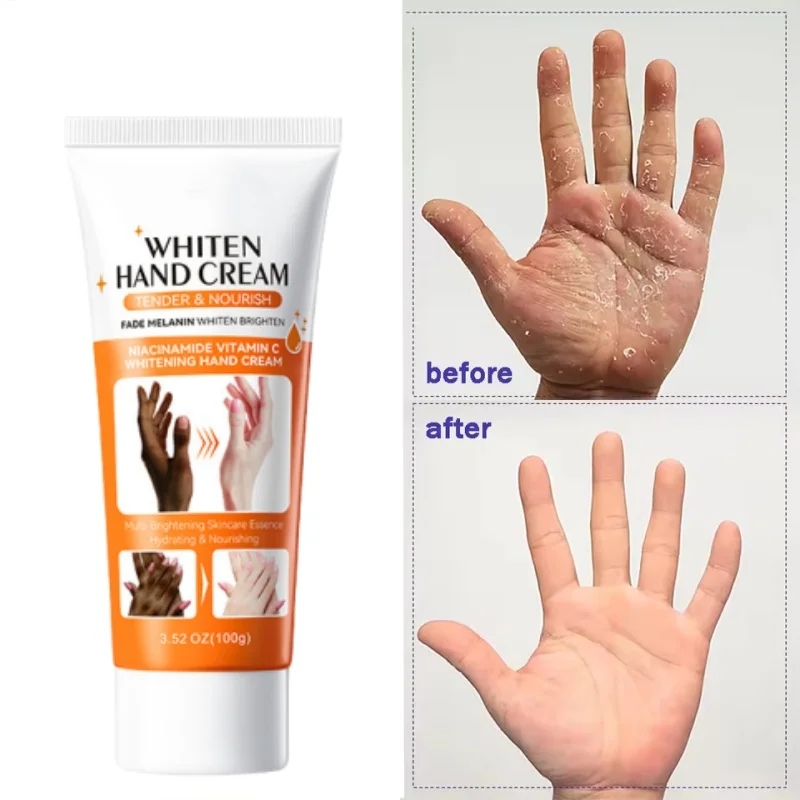 100g Whitening Hand Cream Moisturize Skin, Removal Dark Skin Prevent Cracks on Hands and Feet, and Whitening Body Lotion Care
100g Whitening Hand Cream Moisturize Skin, Removal Dark Skin Prevent Cracks on Hands and Feet, and Whitening Body Lotion Care