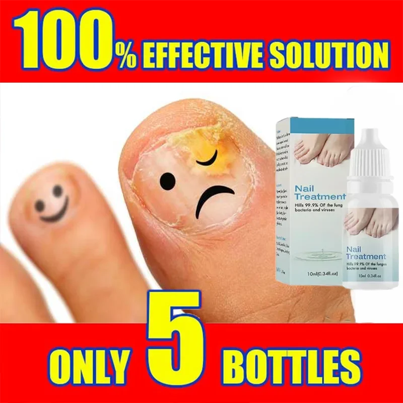 Nail Fungals Renewal Nail Repair Liquid for Discolored Thickened Crumbled Nails Nail Fungals for Discolored Broken Cracked
Nail Fungals Renewal Nail Repair Liquid for Discolored Thickened Crumbled Nails Nail Fungals for Discolored Broken Cracked