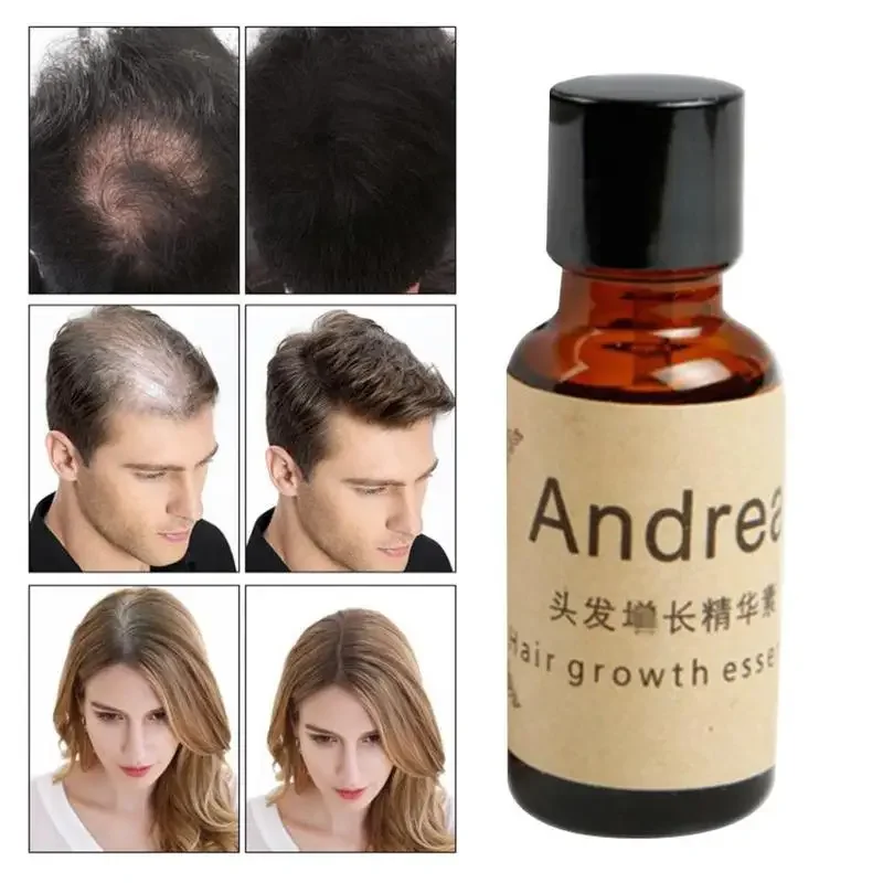 20ml Huile Essentielle Essential Oils Andrea Hair Growth Loss Liquid Grow Restoration Pilatory Dense Fast Sunburst
20ml Huile Essentielle Essential Oils Andrea Hair Growth Loss Liquid Grow Restoration Pilatory Dense Fast Sunburst