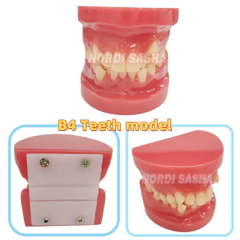 1Pcs Crowded Teeth Orthodontic Model B4 Dental Malocclusion Typodont Jaw Model orthodontic Teaching Practice Teeth Model
1Pcs Crowded Teeth Orthodontic Model B4 Dental Malocclusion Typodont Jaw Model orthodontic Teaching Practice Teeth Model