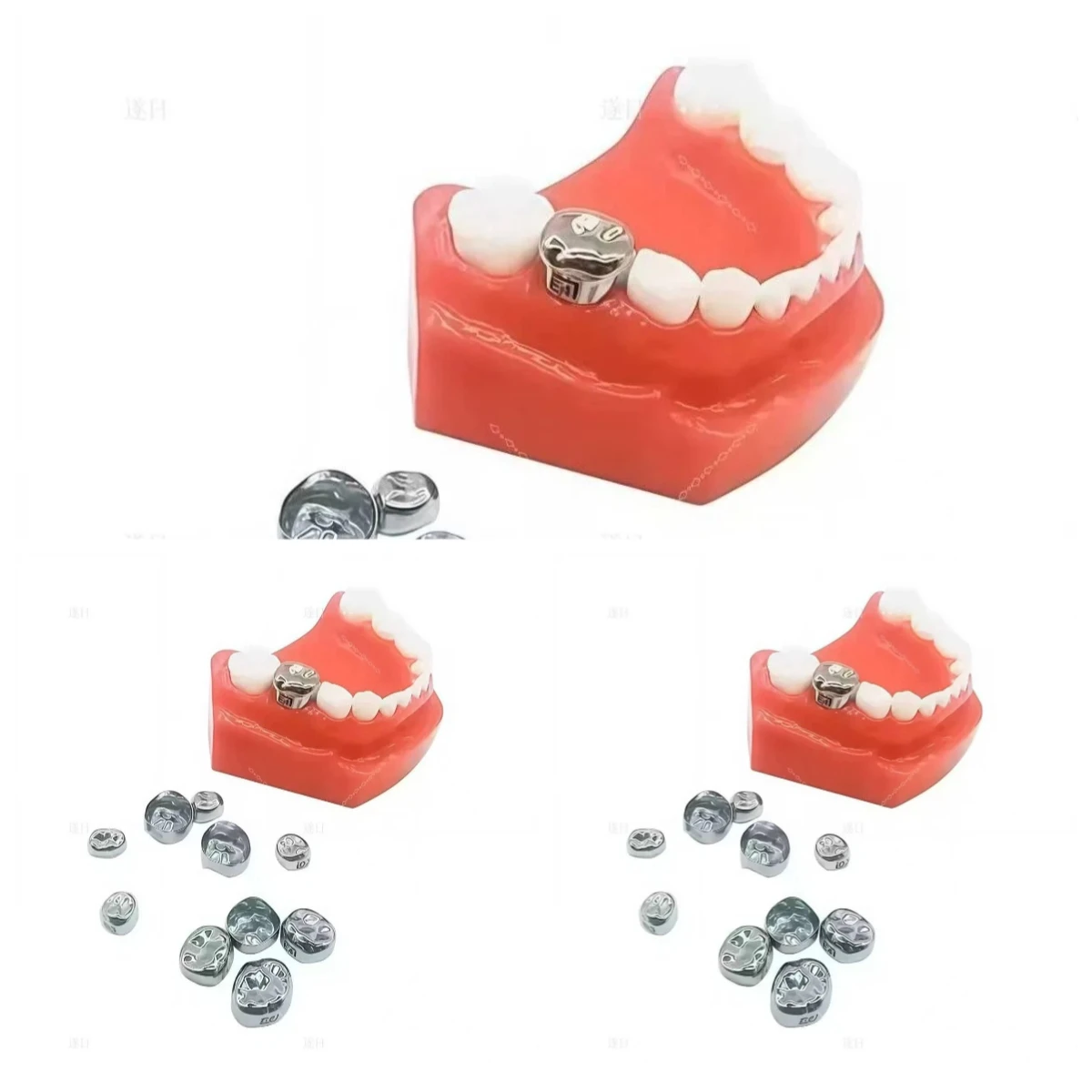 SHINHUNG 10Pcs Pediatric Crowns – Stainless Steel for Primary 1st/2nd Molars. Strong, Reliable Temporary Crowns for Children.
SHINHUNG 10Pcs Pediatric Crowns – Stainless Steel for Primary 1st/2nd Molars. Strong, Reliable Temporary Crowns for Children.