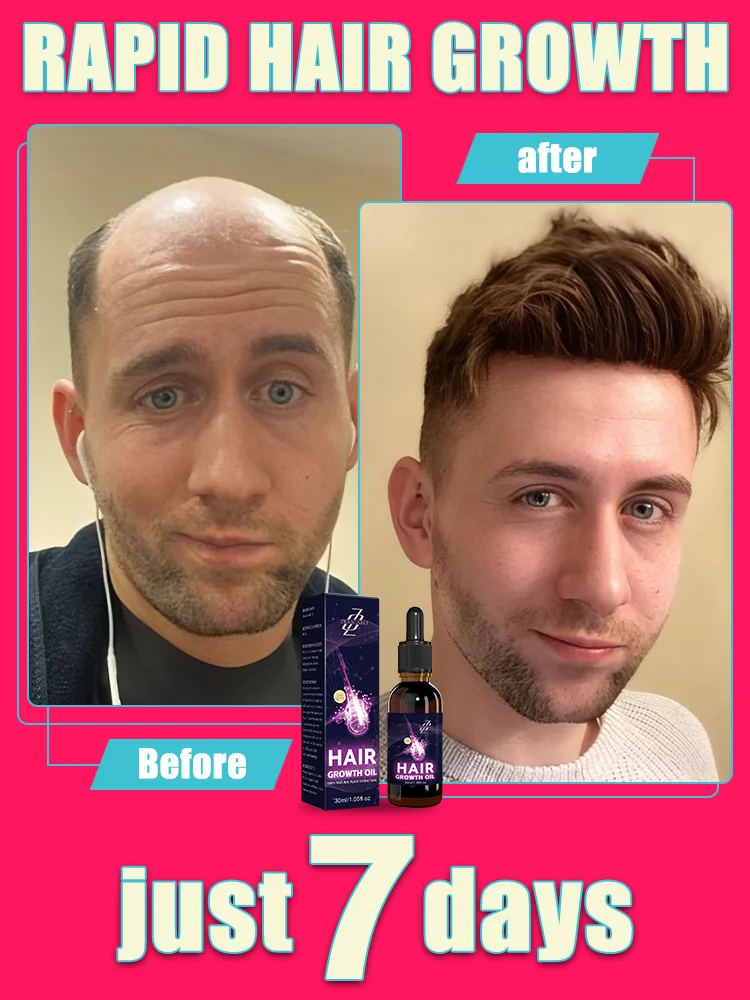 Stay young and energetic, start with having lush hair and restore your thick hair!
Stay young and energetic, start with having lush hair and restore your thick hair!