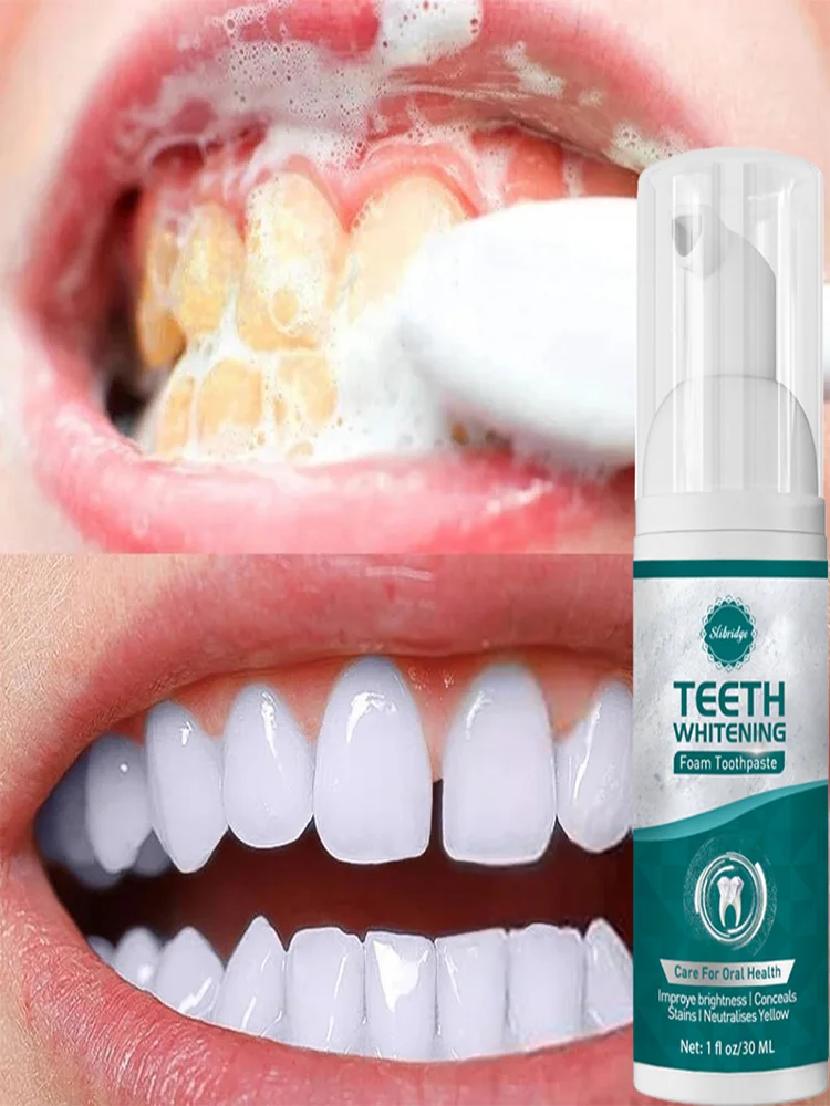 Teeth whitening toothpaste Effective Removes Deep Whitening Stain
Teeth whitening toothpaste Effective Removes Deep Whitening Stain