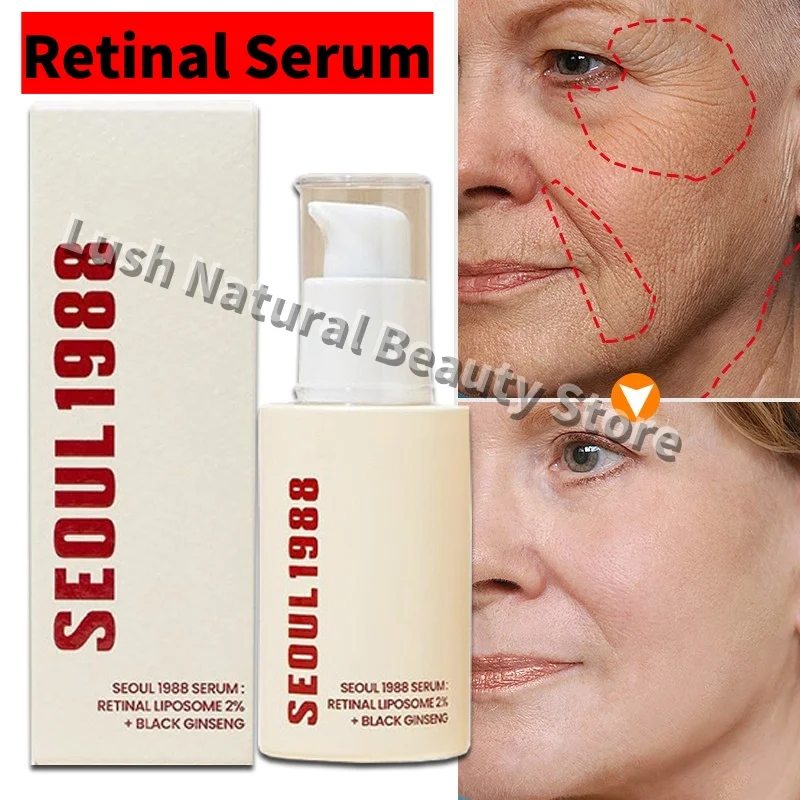 Seoul 1988 2% Retinal Anti Aging Wrinkle Serum Ginseng Facial Essence Firming Pores Brightening Face Moisturizer Korean Skincare
Seoul 1988 2% Retinal Anti Aging Wrinkle Serum Ginseng Facial Essence Firming Pores Brightening Face Moisturizer Korean Skincare