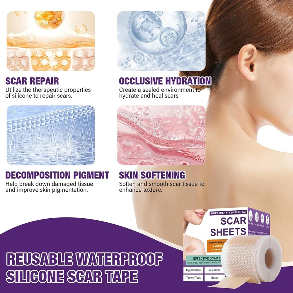 1/2/3 Pcs Silicone Scar Patch Skin Repair Sheets Removal Self-Adhesive Stretch Mark Tape Therapy Patch Burn Scar Skin Care
1/2/3 Pcs Silicone Scar Patch Skin Repair Sheets Removal Self-Adhesive Stretch Mark Tape Therapy Patch Burn Scar Skin Care