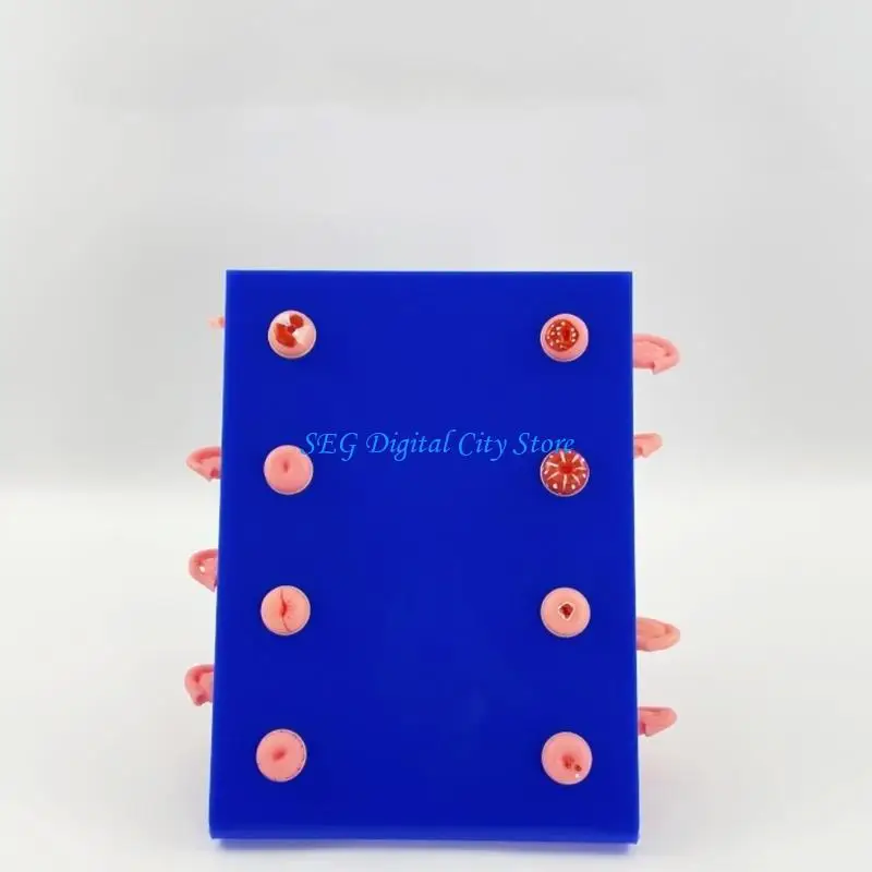U75B Upgrades PVC Uterus Model Set Teaching Tool Showing 8 Common Pathologies for Clinical Teaching & Demonstration
U75B Upgrades PVC Uterus Model Set Teaching Tool Showing 8 Common Pathologies for Clinical Teaching & Demonstration