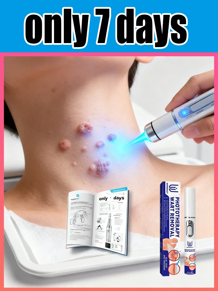 Gᴇɴᴇʀᴀᴛɪᴏɴ-3 Lᴀsᴇʀ Sᴀʏs Gᴏᴏᴅʙʏᴇ Tᴏ Wᴀʀᴛs Iɴ 7 Dᴀʏs
Gᴇɴᴇʀᴀᴛɪᴏɴ-3 Lᴀsᴇʀ Sᴀʏs Gᴏᴏᴅʙʏᴇ Tᴏ Wᴀʀᴛs Iɴ 7 Dᴀʏs