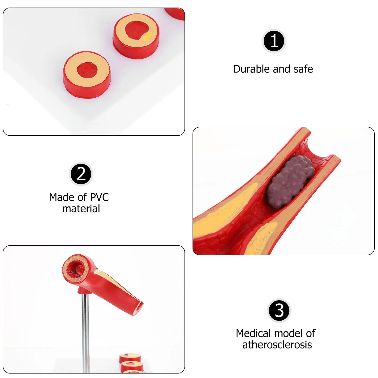 Atherosclerosis Cardiovascular Model, Medical Blood Vessel Anatomical Pathology Model for Education, Arteriosclerosis Vascular
Atherosclerosis Cardiovascular Model, Medical Blood Vessel Anatomical Pathology Model for Education, Arteriosclerosis Vascular