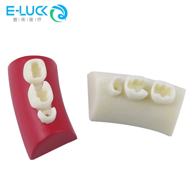 Стоматологическая инкрустация, модель упражнений, блок, тренировочные модели наполнения из композитной смолы для стоматологии, обучающее обучение полости рта, Typodont Study
Стоматологическая инкрустация, модель упражнений, блок, тренировочные модели наполнения из композитной смолы для стоматологии, обучающее обучение полости рта, Typodont Study