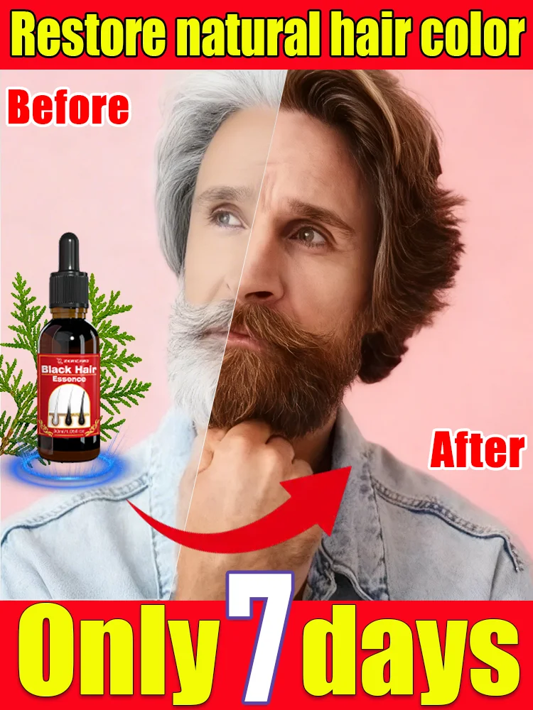 White to Black Hair Serum Gʀᴀʏ Hᴀɪʀ Tʀᴇᴀᴛᴍᴇɴᴛ Nᴀᴛᴜʀᴀʟ Cᴏʟᴏʀ Rᴇᴘᴀɪʀ Nᴏᴜʀɪsʜɪɴɢ Aɴᴛɪ-Hᴀɪʀ Lᴏss Cᴀʀᴇ Mᴇɴ Wᴏᴍᴇɴ
White to Black Hair Serum Gʀᴀʏ Hᴀɪʀ Tʀᴇᴀᴛᴍᴇɴᴛ Nᴀᴛᴜʀᴀʟ Cᴏʟᴏʀ Rᴇᴘᴀɪʀ Nᴏᴜʀɪsʜɪɴɢ Aɴᴛɪ-Hᴀɪʀ Lᴏss Cᴀʀᴇ Mᴇɴ Wᴏᴍᴇɴ