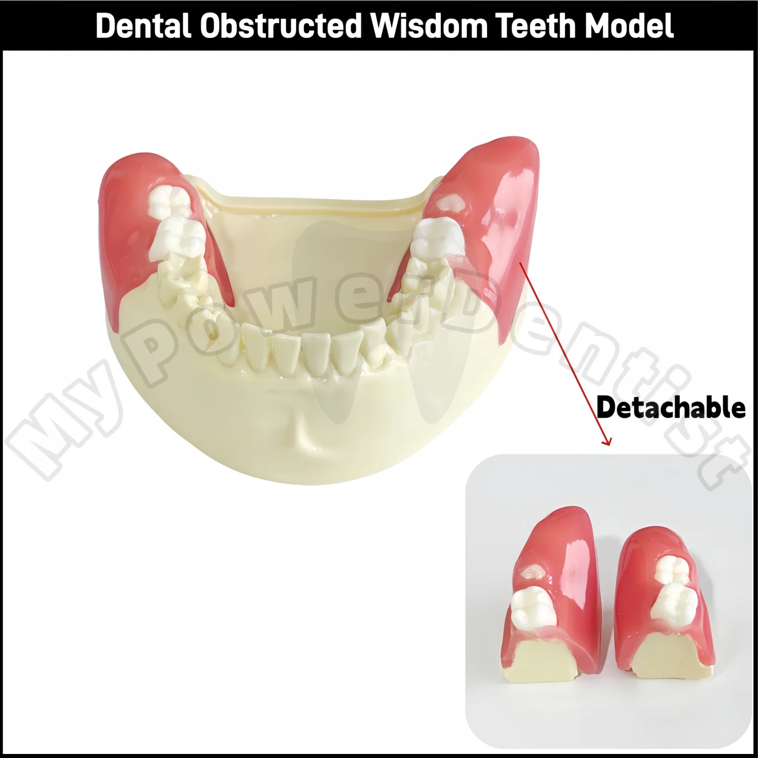 Dental Obstructed Wisdom Teeth Extraction Model Lower Soft Gingiva Wisdom Study Display Detachable Model
Dental Obstructed Wisdom Teeth Extraction Model Lower Soft Gingiva Wisdom Study Display Detachable Model