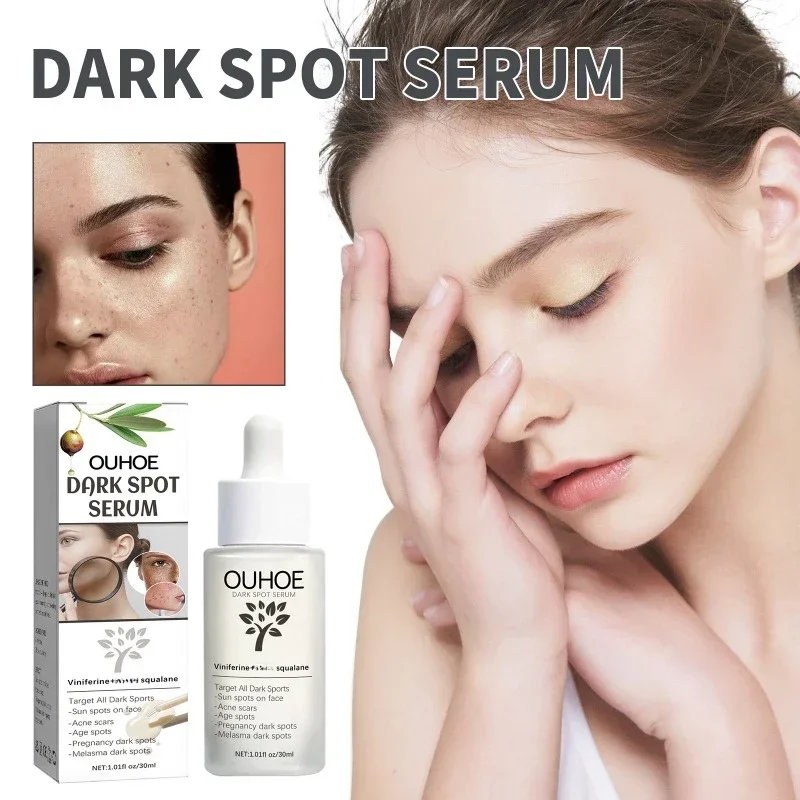 Dark Spots Acne marks removal Essence Whitening Freckle Cream Fade Melanin Repair brighten Face dullness Skin Care Products
Dark Spots Acne marks removal Essence Whitening Freckle Cream Fade Melanin Repair brighten Face dullness Skin Care Products