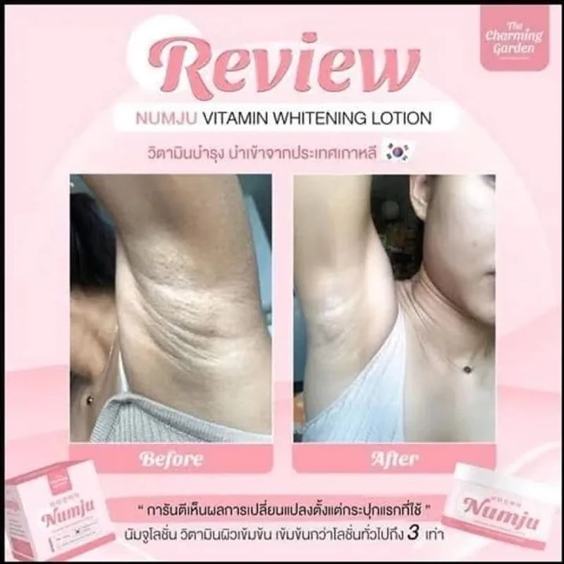 Numju Vitamin Brightening Lotion Lighten Dark Armpits Black Elbows & Knees Groin Reduce Stretch Marks and Moisturize for Bright
Numju Vitamin Brightening Lotion Lighten Dark Armpits Black Elbows & Knees Groin Reduce Stretch Marks and Moisturize for Bright