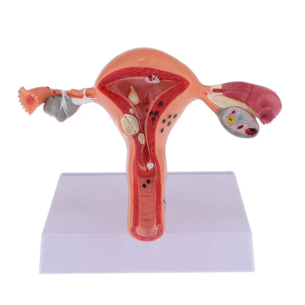 Woman Uterus Structure Biological Model Educational Experiment Laboratory
Woman Uterus Structure Biological Model Educational Experiment Laboratory