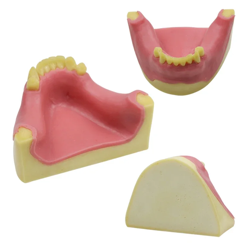Dental Teeth Maxillary Model with Implant Teaching Practice Model Demonstration Teeth Model Dental Tool Dental Materials
Dental Teeth Maxillary Model with Implant Teaching Practice Model Demonstration Teeth Model Dental Tool Dental Materials