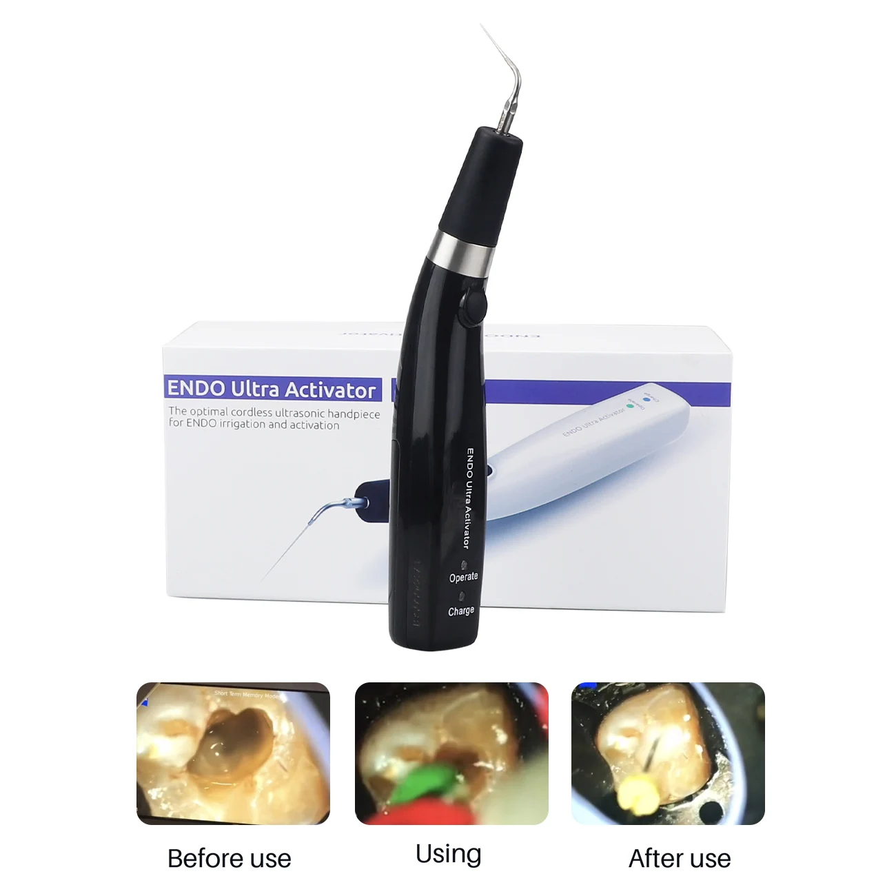 Dental Ultrasonic Activator Wireless Endodontic Irrigator Ultrasonic Handpiece Dentistry Root Canal Instruments Endodontic Tools
Dental Ultrasonic Activator Wireless Endodontic Irrigator Ultrasonic Handpiece Dentistry Root Canal Instruments Endodontic Tools