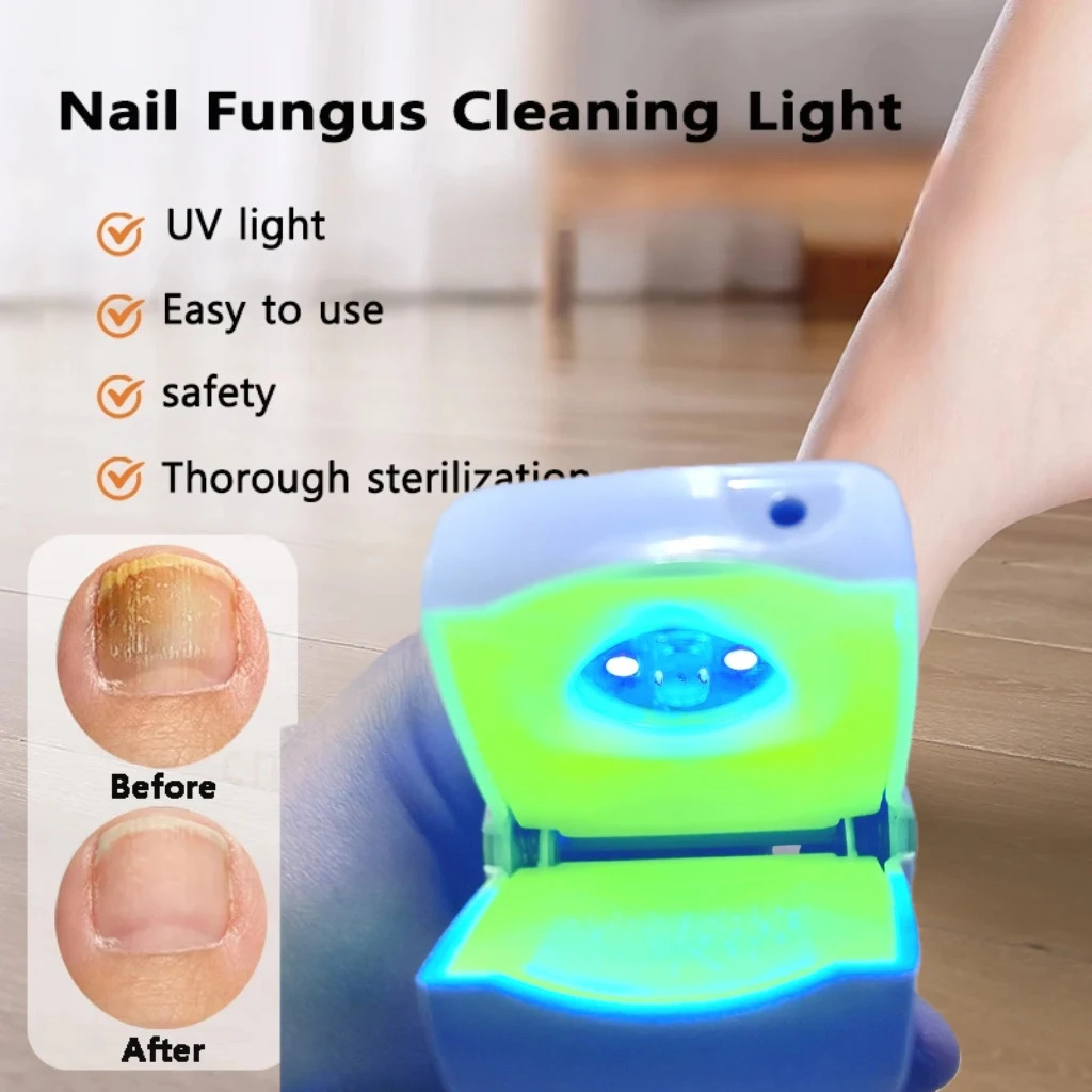 Nail Fungus Remover COZING Rechargeable Laser Device with 470nm Blue Light & 905nm Infrared for Toenail & Finger Fungus
Nail Fungus Remover COZING Rechargeable Laser Device with 470nm Blue Light & 905nm Infrared for Toenail & Finger Fungus