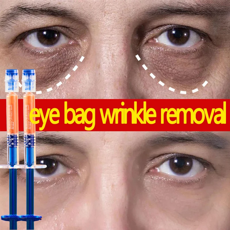 Retinol Anti-Wrinkle Eye Cream Eye Bags Dark Circles Removal Fine Lines Moisturizing Brightenning Tighten Eyes Korean Cosmetics
Retinol Anti-Wrinkle Eye Cream Eye Bags Dark Circles Removal Fine Lines Moisturizing Brightenning Tighten Eyes Korean Cosmetics