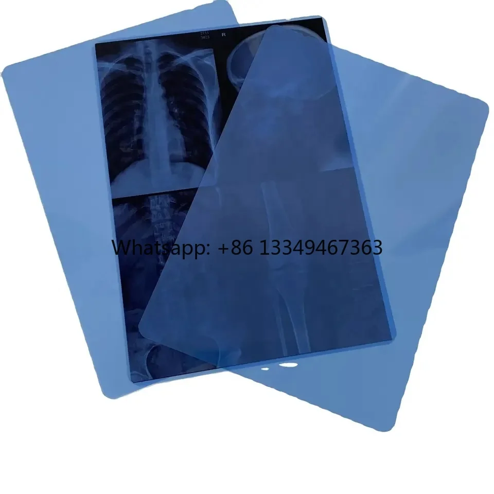 wholesale Wholesale Medical PET Film X-ray Printer Inkjet Film Blue Medical Printing Film for Sale in stock
wholesale Wholesale Medical PET Film X-ray Printer Inkjet Film Blue Medical Printing Film for Sale in stock