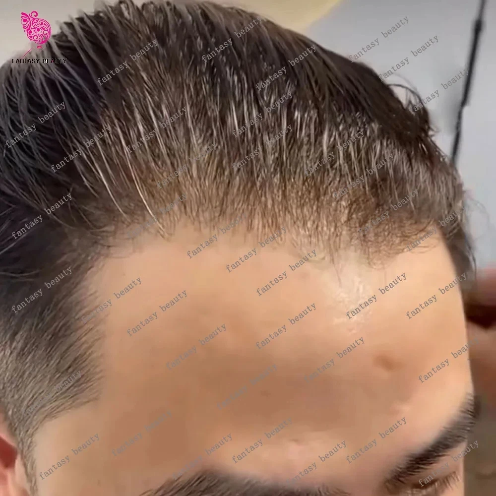 Невидимый мужской парик с естественной линией роста волос, плотность 80-100%, ультратонкая основа 0.02 мм, цвета: блонд, коричневый, серый, черный # Система для восстановления волос из 240 прядей натуральных волос
Невидимый мужской парик с естественной линией роста волос, плотность 80-100%, ультратонкая основа 0.02 мм, цвета: блонд, коричневый, серый, черный # Система для восстановления волос из 240 прядей натуральных волос